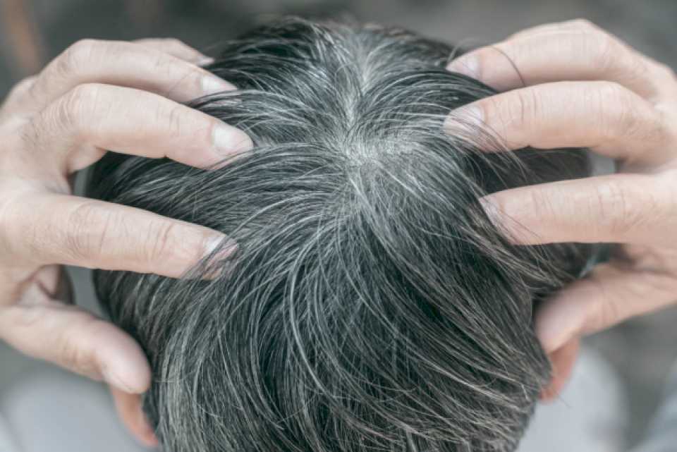 La ciencia explica por qué salen las canas