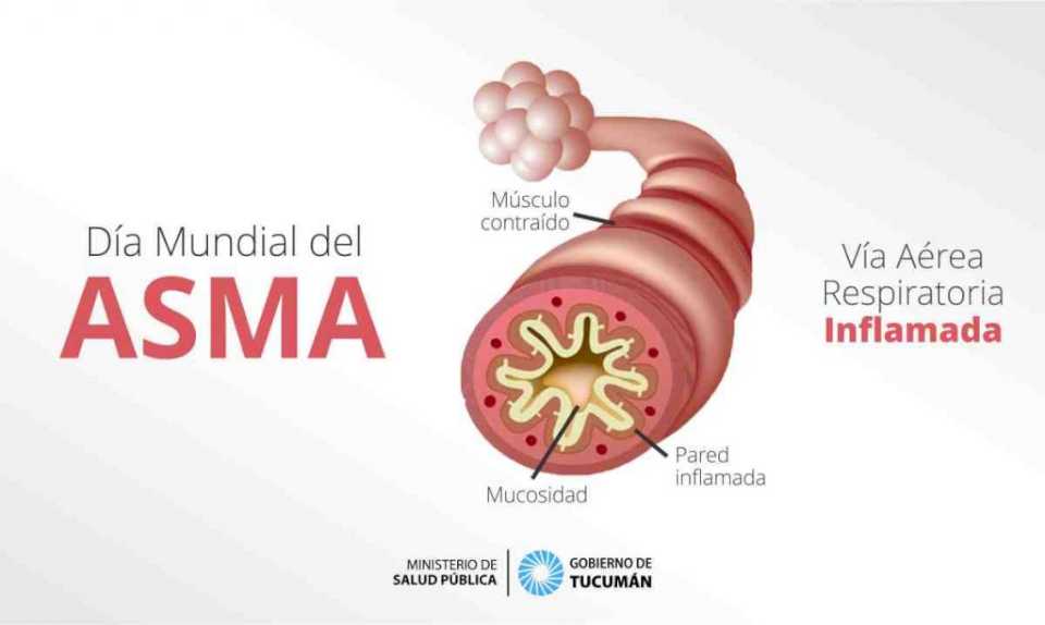 Día Mundial del Asma