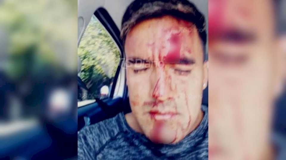 Le dieron un puntazo y molieron a golpes a un futbolista sanjuanino