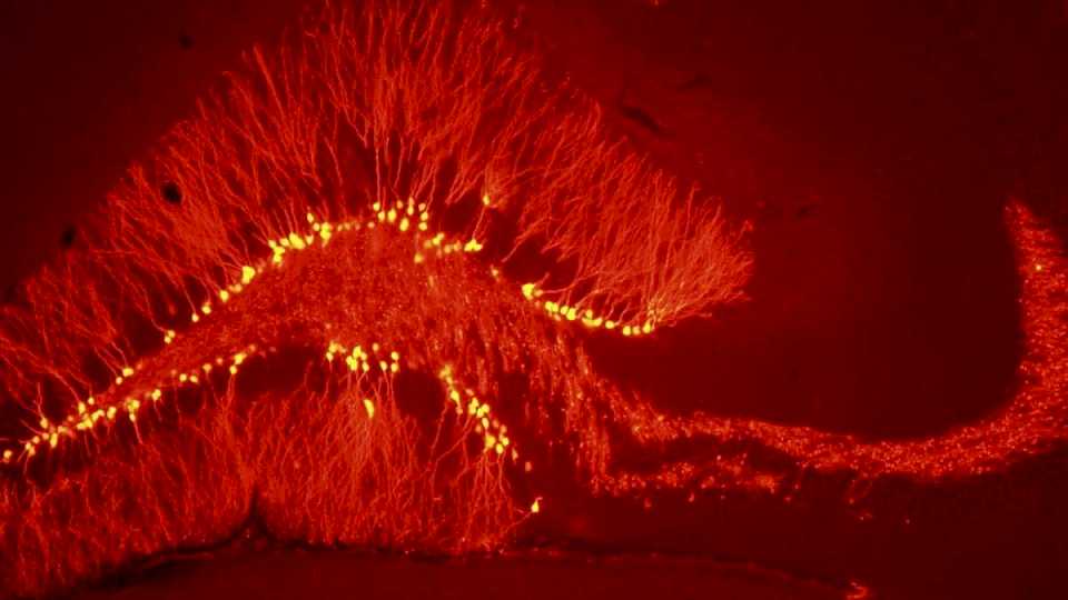 la-investigacion-que-detecto-que-el-cerebro-genera-neuronas-para-«remodelar»-memorias