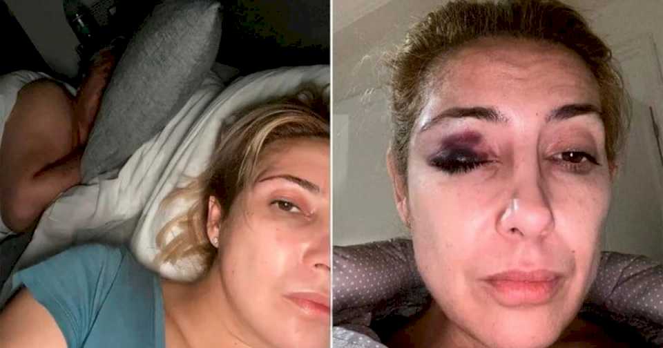 Revelan nuevas fotos de Fabiola Yañez con golpes en su cara: en una aparece Alberto Fernández acostado a su lado