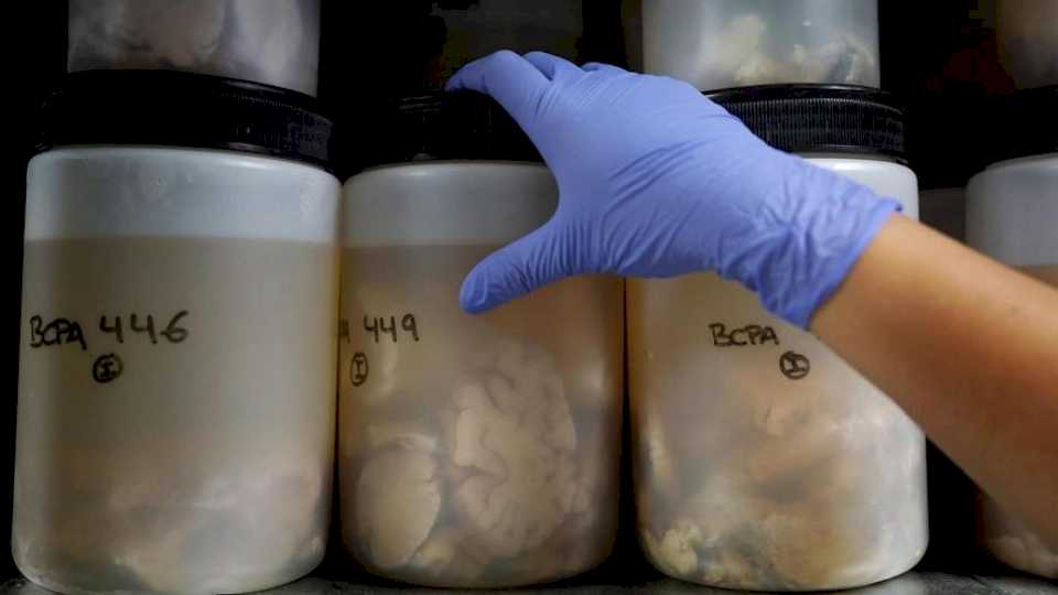 Un macroestudio buscará nuevos genes del alzhéimer en el mayor banco de cerebros de la Península